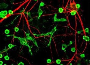 INA / Alpha Internexin Antibody - Immunostaining of cultured neurons and glia showing specific labeling of neuronal processes (red) using our alpha-internexin antibody and microglia (green) with a coronin 1a antibody