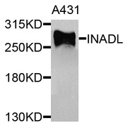 INADL / PATJ Antibody - Western blot blot of extracts of A431 cells, using INADL antibody.