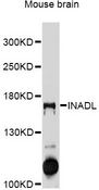 INADL / PATJ Antibody - Western blot analysis of extracts of mouse brain, using INADL antibody at 1:1000 dilution. The secondary antibody used was an HRP Goat Anti-Rabbit IgG (H+L) at 1:10000 dilution. Lysates were loaded 25ug per lane and 3% nonfat dry milk in TBST was used for blocking. An ECL Kit was used for detection and the exposure time was 90s.