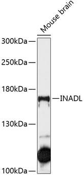 INADL / PATJ Antibody - Western blot analysis of extracts of mouse brain using INADL Polyclonal Antibody at dilution of 1:1000.