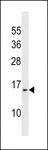INAFM1 / PRR24 Antibody - PRR24 Antibody western blot of MDA-MB453 cell line lysates (35 ug/lane). The PRR24 antibody detected the PRR24 protein (arrow).