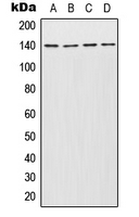 INCENP Antibody - Western blot analysis of INCENP expression in Jurkat (A); Molt4 (B); SP2/0 (C); PC12 (D) whole cell lysates.