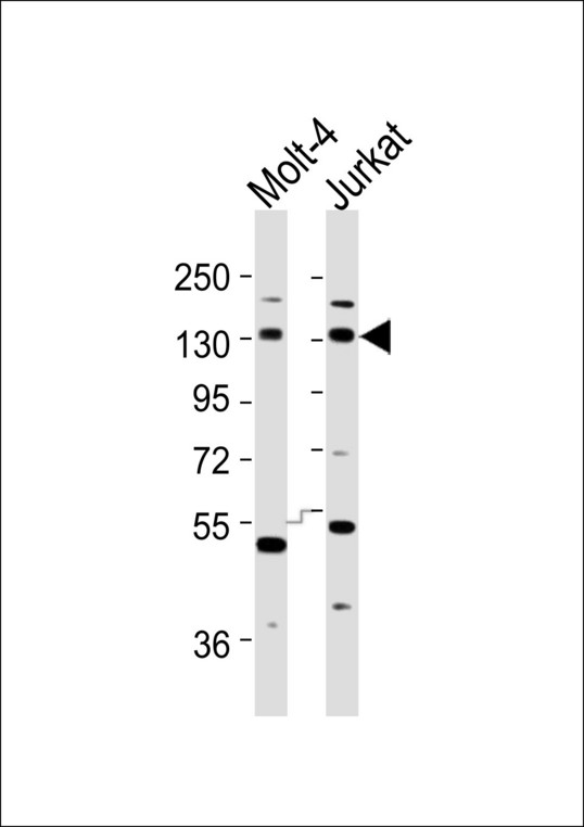 INCENP Antibody - All lanes : Anti-INCENP Antibody at 1:1000 dilution Lane 1: Molt-4 whole cell lysates Lane 2: Jurkat whole cell lysates Lysates/proteins at 20 ug per lane. Secondary Goat Anti-Rabbit IgG, (H+L),Peroxidase conjugated at 1/10000 dilution Predicted band size : 105 kDa Blocking/Dilution buffer: 5% NFDM/TBST.