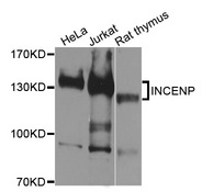 INCENP Antibody - Western blot analysis of extracts of various cell lines, using INCENP antibody at 1:1000 dilution. The secondary antibody used was an HRP Goat Anti-Rabbit IgG (H+L) at 1:10000 dilution. Lysates were loaded 25ug per lane and 3% nonfat dry milk in TBST was used for blocking. An ECL Kit was used for detection and the exposure time was 30s.