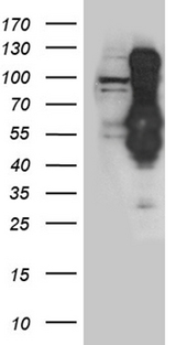 INCENP Antibody - HEK293T cells were transfected with the pCMV6-ENTRY control. (Left lane) or pCMV6-ENTRY INCENP. (Right lane) cDNA for 48 hrs and lysed