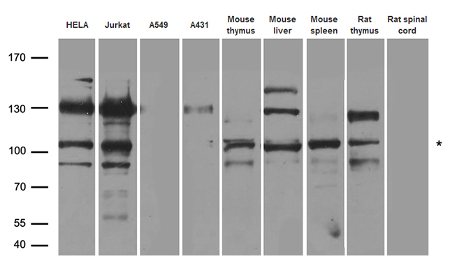 INCENP Antibody - Western blot analysis of extracts. (35ug) from different cell lines and tissues by using anti-INCENP rabbit polyclonal antibody.