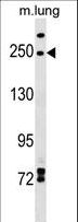 INF2 Antibody - INF2 Antibody western blot of mouse lung tissue lysates (35 ug/lane). The INF2 antibody detected the INF2 protein (arrow).