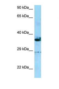 INF2 Antibody - INF2 antibody Western blot of HepG2 Cell lysate. Antibody concentration 1 ug/ml.  This image was taken for the unconjugated form of this product. Other forms have not been tested.