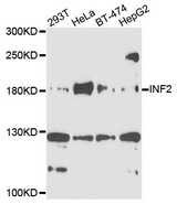 INF2 Antibody - Western blot analysis of extracts of various cell lines, using INF2 antibody at 1:1000 dilution. The secondary antibody used was an HRP Goat Anti-Rabbit IgG (H+L) at 1:10000 dilution. Lysates were loaded 25ug per lane and 3% nonfat dry milk in TBST was used for blocking. An ECL Kit was used for detection and the exposure time was 90s.
