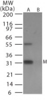 Influenza A H9N2 M1 Antibody - Western blot of avian flu matrix protein 1in (A) recombinant fusion protein containing amino acids212-225 and (B) fusion partner without these amino acids, using antibody at 0.5 ug/ml.