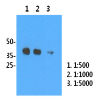 Influenza A Virus H1 Antibody - Western Blot: H1N1/HA1 recombinant protein (50ng) were resolved by SDS-PAGE, transferred to PVDF membrane and probed with anti-human H1N1/HA1 antibody (1:500). (1:1000), (1:5000). Proteins were visualized using a goat anti-mouse secondary antibody conjugated to HRP and an ECL detection system.