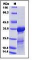 Influenza A Virus H3N2 Matrix Protein