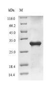 Influenza A Virus Hemagglutinin Protein - (Tris-Glycine gel) Discontinuous SDS-PAGE (reduced) with 5% enrichment gel and 15% separation gel.