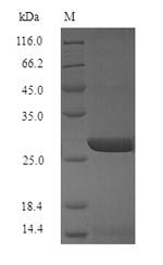 Influenza A Virus Hemagglutinin Protein - (Tris-Glycine gel) Discontinuous SDS-PAGE (reduced) with 5% enrichment gel and 15% separation gel.