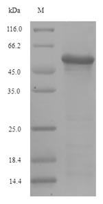 Influenza A Virus Hemagglutinin Protein - (Tris-Glycine gel) Discontinuous SDS-PAGE (reduced) with 5% enrichment gel and 15% separation gel.