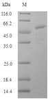 Influenza A Virus Hemagglutinin Protein - (Tris-Glycine gel) Discontinuous SDS-PAGE (reduced) with 5% enrichment gel and 15% separation gel.