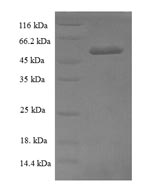 Influenza A H5N1 M2 Protein - (Tris-Glycine gel) Discontinuous SDS-PAGE (reduced) with 5% enrichment gel and 15% separation gel.