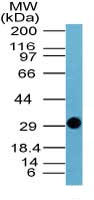 Influenza A Virus NS1 Antibody - Western blot of Influenza A NS in a partial recombinant fusion protein containing amino acids DQKLGDAPFLDRLRRD using Peptide-affinity Purified Polyclonal Antibody to Influenza A NS Protein at 0.1 ug/ml. Goat anti-rabbit Ig HRP secondary antibody, and PicoTect ECL substrate solution, were used for this test.