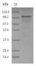 Nucleocapsid Protein Protein - (Tris-Glycine gel) Discontinuous SDS-PAGE (reduced) with 5% enrichment gel and 15% separation gel.