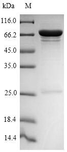 Nucleocapsid Protein Protein - (Tris-Glycine gel) Discontinuous SDS-PAGE (reduced) with 5% enrichment gel and 15% separation gel.