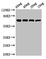Influenza A Virus Nucleoprotein Antibody - Positive Western Blot detected in Recombinant protein All lanes NP antibody at 3 µg/ml Secondary Goat polyclonal to rabbit IgG at 1/50000 dilution. Predicted band size: 71 KDa. Observed band size: 71 KDa