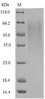 NS1 Protein - (Tris-Glycine gel) Discontinuous SDS-PAGE (reduced) with 5% enrichment gel and 15% separation gel. The reducing (R) protein migrates as 65 kDa in SDS-PAGE may be due to glycosylation.