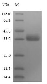 NS1 Protein - (Tris-Glycine gel) Discontinuous SDS-PAGE (reduced) with 5% enrichment gel and 15% separation gel.