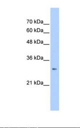 ING1 Antibody - HepG2 cell lysate. Antibody concentration: 2.5 ug/ml. Gel concentration: 12%.  This image was taken for the unconjugated form of this product. Other forms have not been tested.