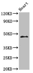 ING1 Antibody - Positive Western Blot detected in Mouse heart tissue. All lanes: ING1 antibody at 3.2 µg/ml Secondary Goat polyclonal to rabbit IgG at 1/50000 dilution. Predicted band size: 47, 32, 24, 27, 30 KDa. Observed band size: 47 KDa