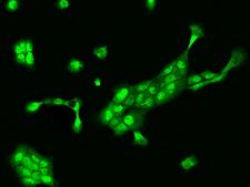 ING1 Antibody - Immunofluorescence staining of ING1 in A431 cells. Cells were fixed with 4% PFA, permeabilzed with 0.3% Triton X-100 in PBS, blocked with 10% serum, and incubated with rabbit anti-Human ING1 polyclonal antibody (dilution ratio 1:200) at 4°C overnight. Then cells were stained with the Alexa Fluor 488-conjugated Goat Anti-rabbit IgG secondary antibody (green). Positive staining was localized to Nucleus and Cytoplasm.