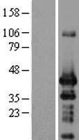 ING1 Protein - Western validation with an anti-DDK antibody * L: Control HEK293 lysate R: Over-expression lysate