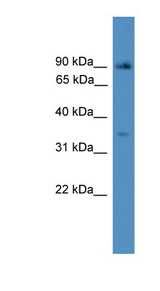 ING2 Antibody - ING2 antibody Western blot of COLO205 cell lysate. This image was taken for the unconjugated form of this product. Other forms have not been tested.