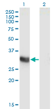 ING2 Antibody - Western Blot analysis of ING2 expression in transfected 293T cell line by ING2 monoclonal antibody (M05), clone 1D1.Lane 1: ING2 transfected lysate (Predicted MW: 32.8 KDa).Lane 2: Non-transfected lysate.