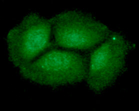 ING2 Antibody - ICC/IF analysis of ING2 in Hep3B cells line, stained with DAPI (Blue) for nucleus staining and monoclonal anti-human ING2 antibody (1:100) with goat anti-mouse IgG-Alexa fluor 488 conjugate (Green).