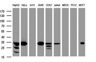 ING2 Antibody - Western blot of extracts (35ug) from 9 different cell lines by using anti-ING2 monoclonal antibody (HepG2: human; HeLa: human; SVT2: mouse; A549: human; COS7: monkey; Jurkat: human; MDCK: canine; PC12: rat; MCF7: human).