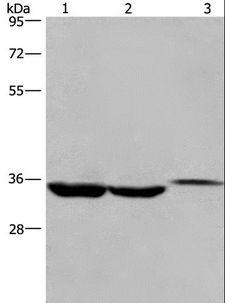 ING2 Antibody - Western blot analysis of Lovo cell,human liver cancer tissue and mouse kidney tissue, using ING2 Polyclonal Antibody at dilution of 1:425.