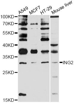 ING2 Antibody - Western blot analysis of extracts of various cell lines, using ING2 antibody at 1:3000 dilution. The secondary antibody used was an HRP Goat Anti-Rabbit IgG (H+L) at 1:10000 dilution. Lysates were loaded 25ug per lane and 3% nonfat dry milk in TBST was used for blocking. An ECL Kit was used for detection and the exposure time was 30s.