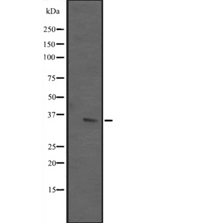 ING2 Antibody - Western blot analysis of ING2 expression in T47D cells lysate. The lane on the left is treated with the antigen-specific peptide.