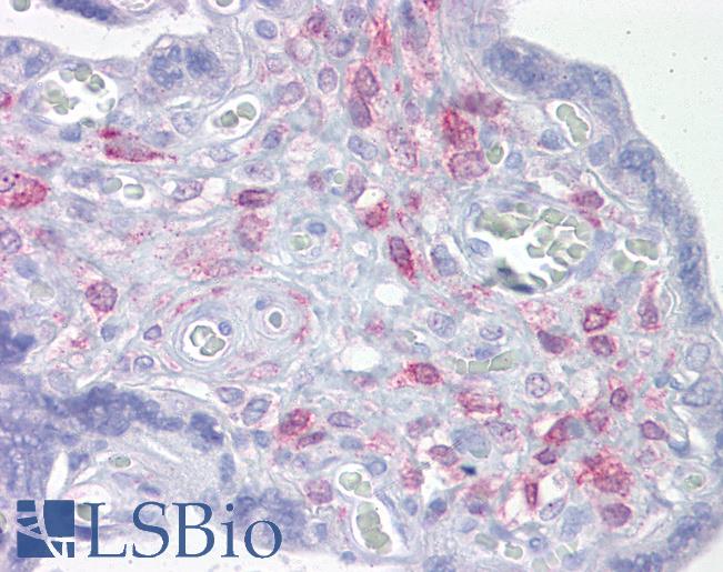 ING3 Antibody - Anti-ING3 antibody IHC of human placenta. Immunohistochemistry of formalin-fixed, paraffin-embedded tissue after heat-induced antigen retrieval. Antibody concentration 5 ug/ml.  This image was taken for the unconjugated form of this product. Other forms have not been tested.