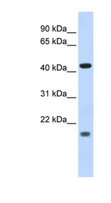 ING3 Antibody - ING3 antibody Western blot of Fetal Heart lysate. This image was taken for the unconjugated form of this product. Other forms have not been tested.