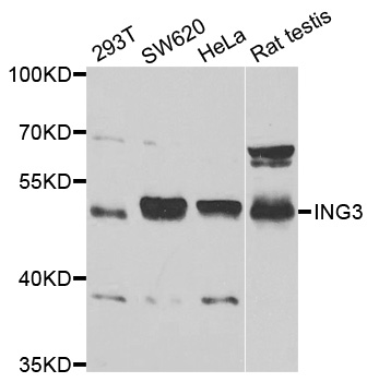 ING3 Antibody - Western blot analysis of extracts of various cell lines.