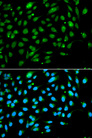 ING3 Antibody - Immunofluorescence analysis of A549 cells.