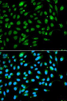 ING3 Antibody - Immunofluorescence analysis of A549 cells.