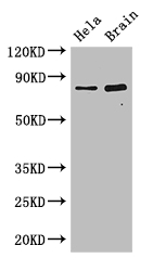 ING3 Antibody - Positive WB detected in:Hela whole cell lysate,Mouse brain tissue;All lanes: DACH1 antibody at 2.8ug/ml;Secondary;Goat polyclonal to rabbit IgG at 1/50000 dilution;Predicted band size: 47,12 kDa;Observed band size: 79 kDa;