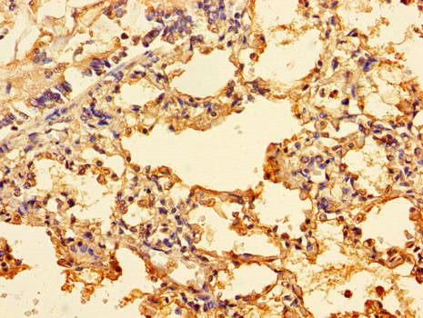 ING3 Antibody - Immunohistochemistry of paraffin-embedded human lung tissue using ING3 Antibody at dilution of 1:100