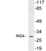 ING4 Antibody - Western blot analysis of lysates from 293 cells, using ING4 antibody.