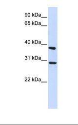 ING4 Antibody - 293T cell lysate. Antibody concentration: 1.0 ug/ml. Gel concentration: 12%.  This image was taken for the unconjugated form of this product. Other forms have not been tested.