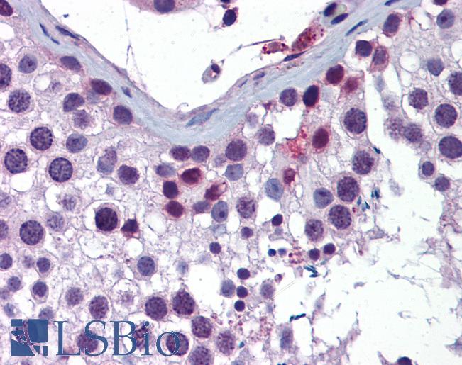 ING4 Antibody - Anti-ING4 antibody IHC of human testis. Immunohistochemistry of formalin-fixed, paraffin-embedded tissue after heat-induced antigen retrieval. Antibody concentration 5 ug/ml.  This image was taken for the unconjugated form of this product. Other forms have not been tested.
