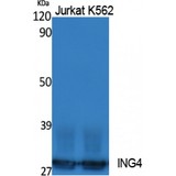 ING4 Antibody - Western blot of ING4 antibody