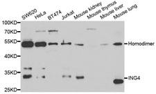 ING4 Antibody - Western blot analysis of extracts of various cell lines.
